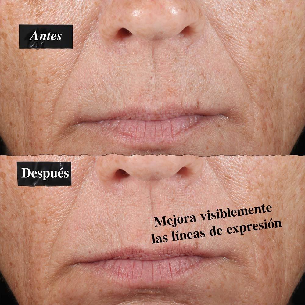 KIEHL'S, MIDNIGHT RECOVERY SERUM HIDRATANTE ANTI-SIGNOS DE LA EDAD (S&Eacute;RUM FACIAL)